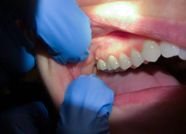 Best Weekend Emergency Dentist in Liberty, TX