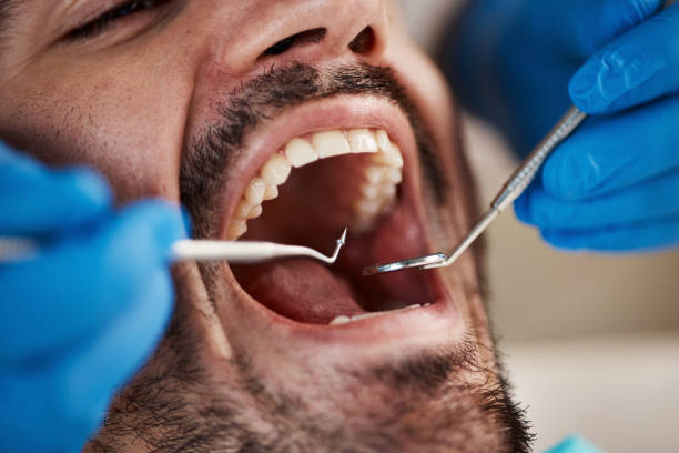 Best Emergency Treatment for Dental Infections or Abscesses in Liberty, TX
